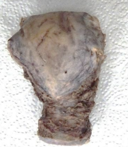 Description of the image